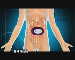 胃十二指肠溃疡