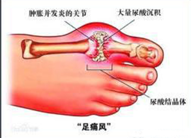 龙马治疗仪