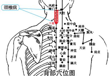 龙马颈椎治疗器