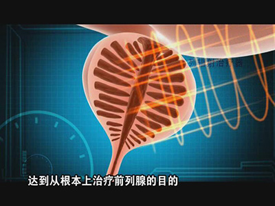 龙马治疗器能从根本上治疗前列腺