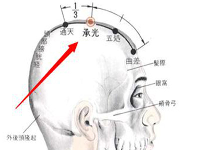 龙马治疗器厂家