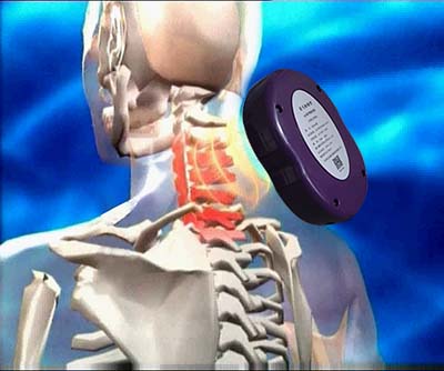 1488590496160318.jpg 颈椎疼.jpg