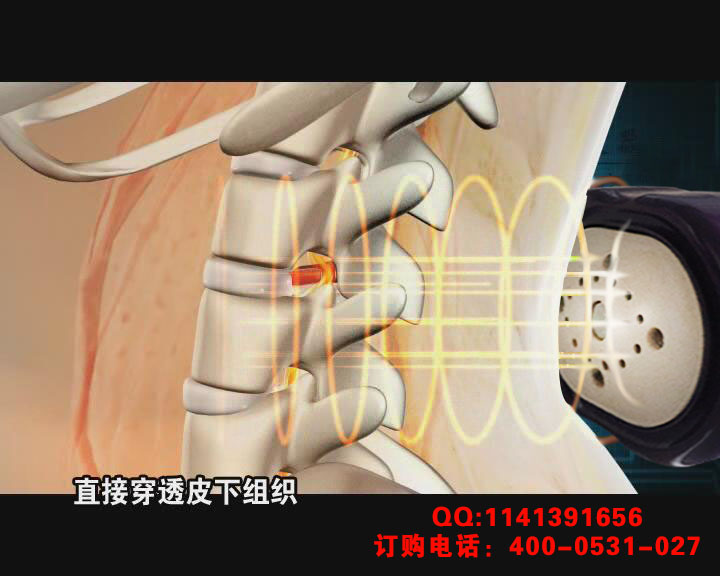 腰椎间盘突出治疗仪 腰椎间盘突出治疗仪