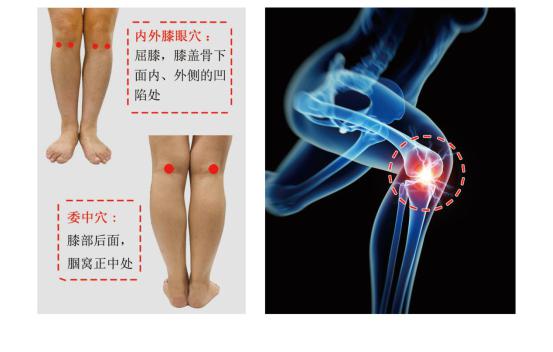 膝关节治疗仪 膝关节治疗仪