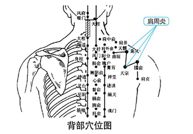 龙马治疗仪